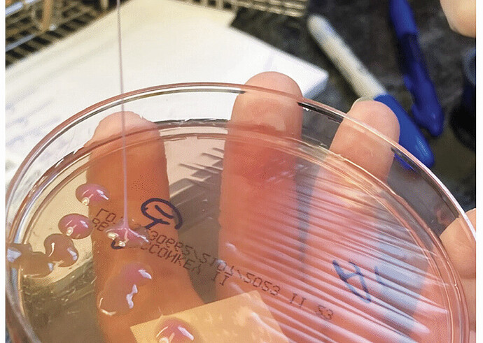 เตือนภัยเชื้อดื้อยา! แบคทีเรีย 'Klebsiella pneumoniae' สายพันธุ์ดุร้าย ทำลายอวัยวะชายวัย 63 ปอด ตับ สมองอักเสบ